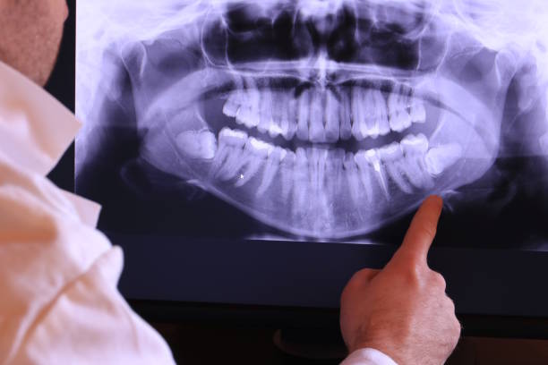 Best Dentist for Tooth Abscess  in Olympia, SC