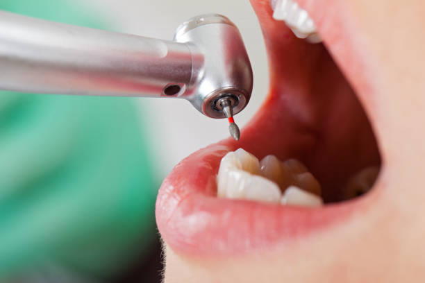 Best Broken Tooth Emergency  in Olympia, SC